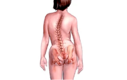 Le ragioni dello sviluppo dell'osteocondosi della cervice