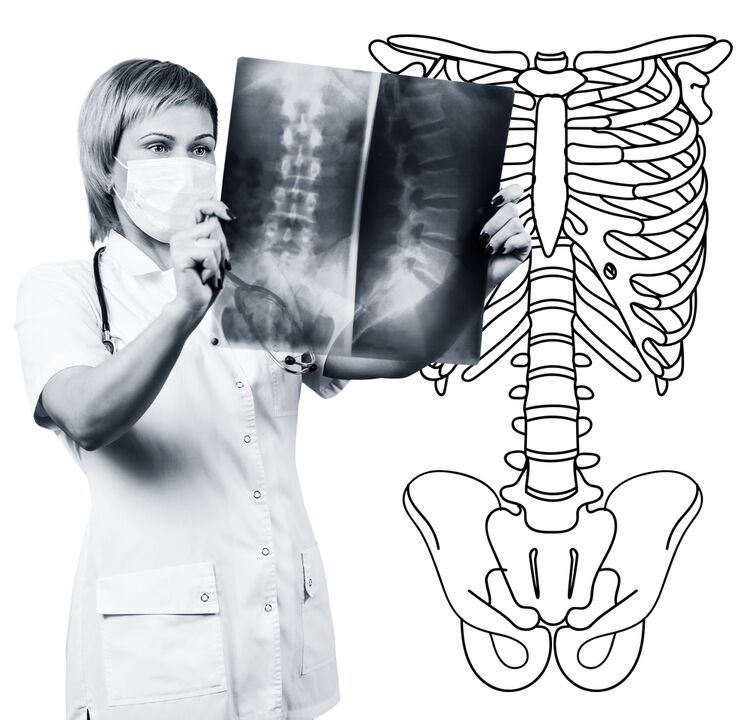 Radiografia della colonna lombare