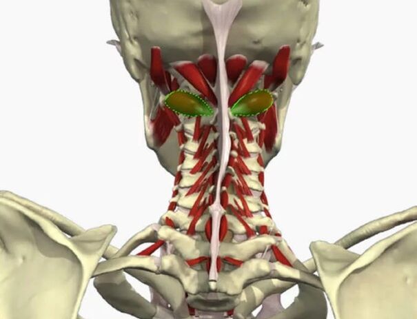 Sindrome di Vail Arteries